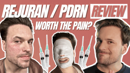 Rejuran Skincare Treatment in Seoul