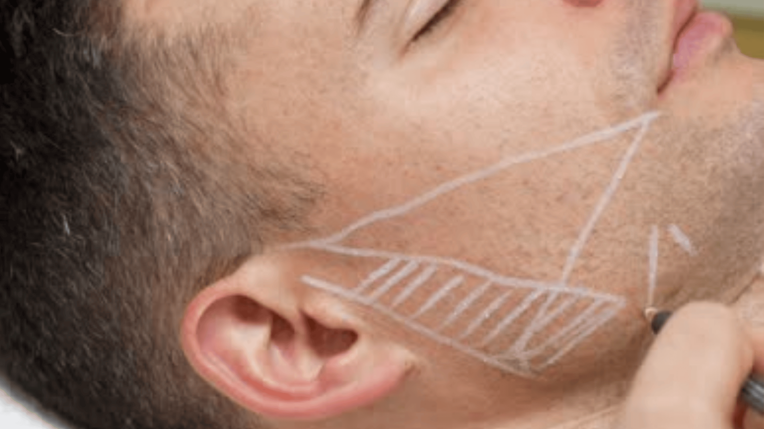 surgeon draws vector lines on male patient considering facelift