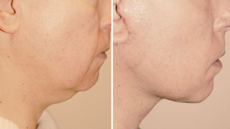 Dr. Sam Rizk's patient before-after