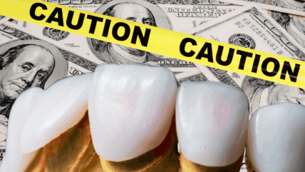 veneers with caution tape + stacks of $100 bills
